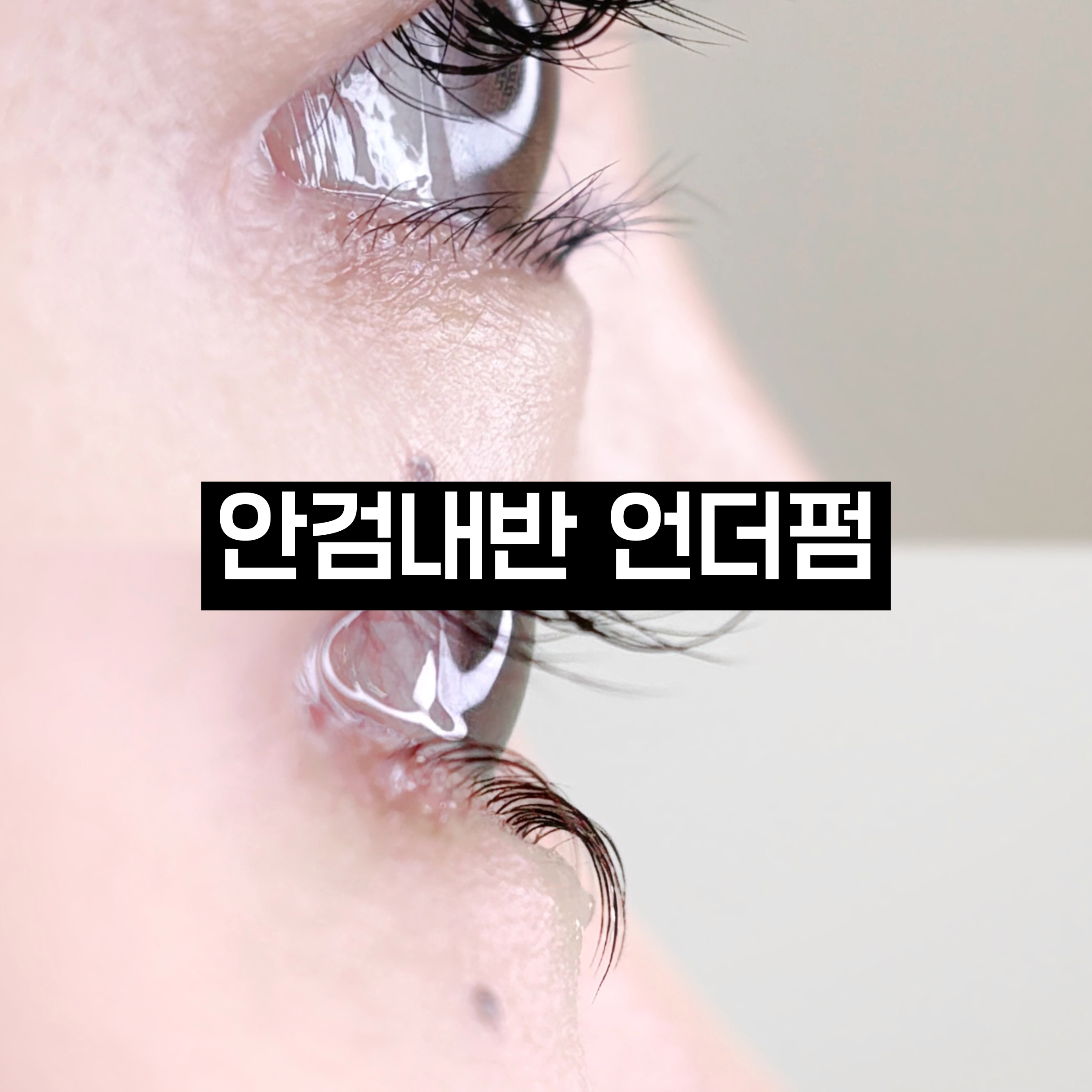 언더펌 시술 결과 3